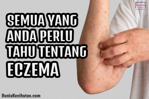 Semua yang Anda Perlu Tahu Tentang Eczema