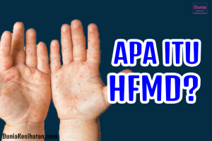 Apa Itu Penyakit Tangan, Kaki dan Mulut (HFMD)
